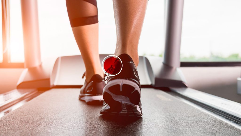 applicazione cerotto per vesciche Prontex